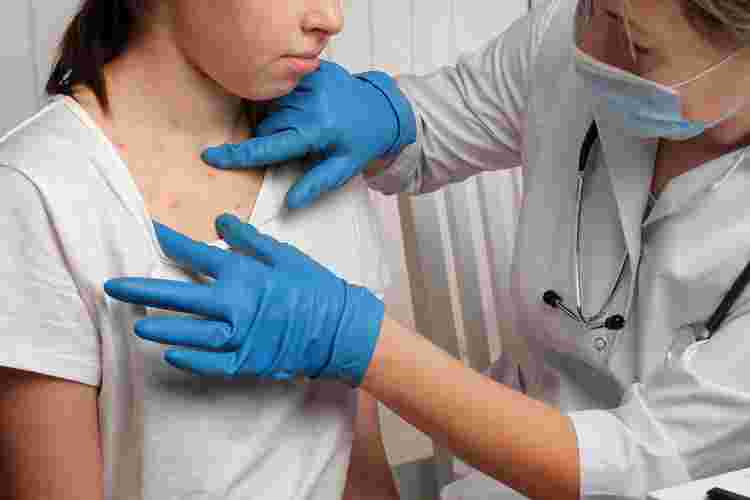 Understanding Measles in Adults