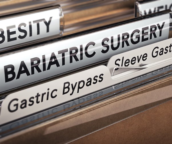 Bariatric surgery and COVID-19: Why the coronavirus is sparking interest in weight loss surgery