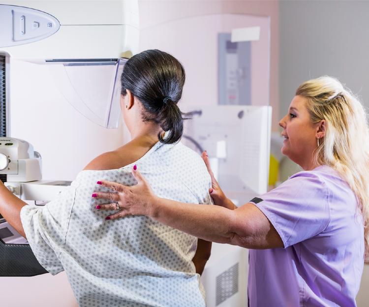 When Should You Start Getting Mammograms? Here's What You Need to Know