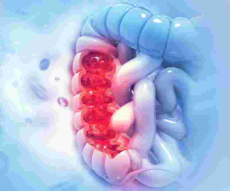 Understanding Colorectal Cancer Risk and Prevention