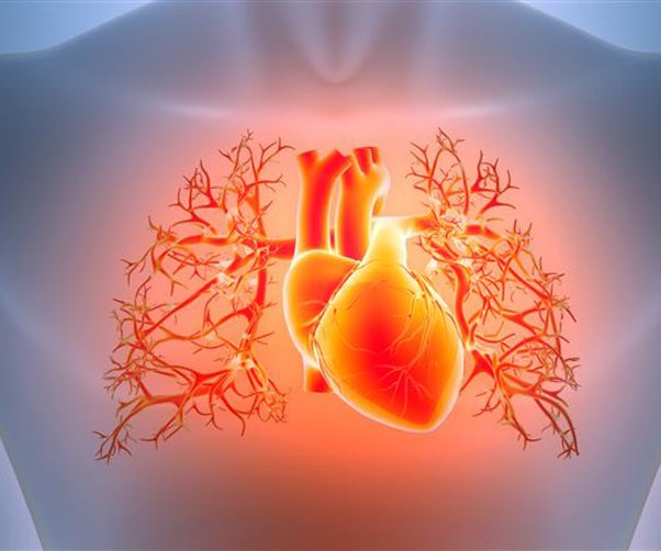 What Is Plaque Buildup—and Why Does It Matter for Heart Health?