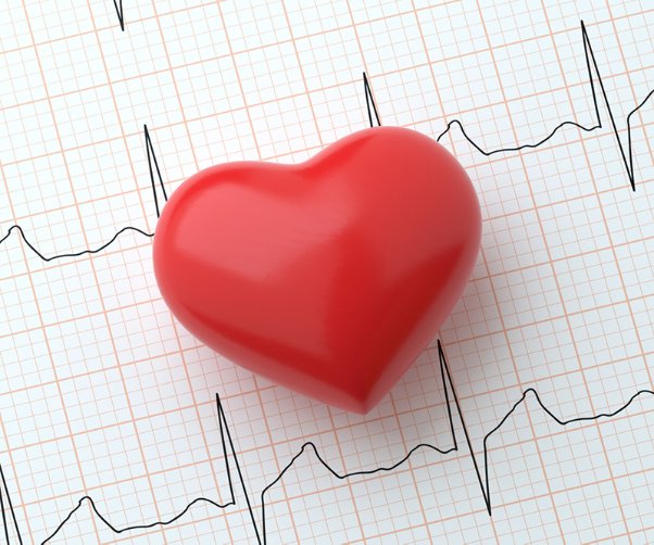 AFib: What is atrial fibrillation and how can it impact your health?