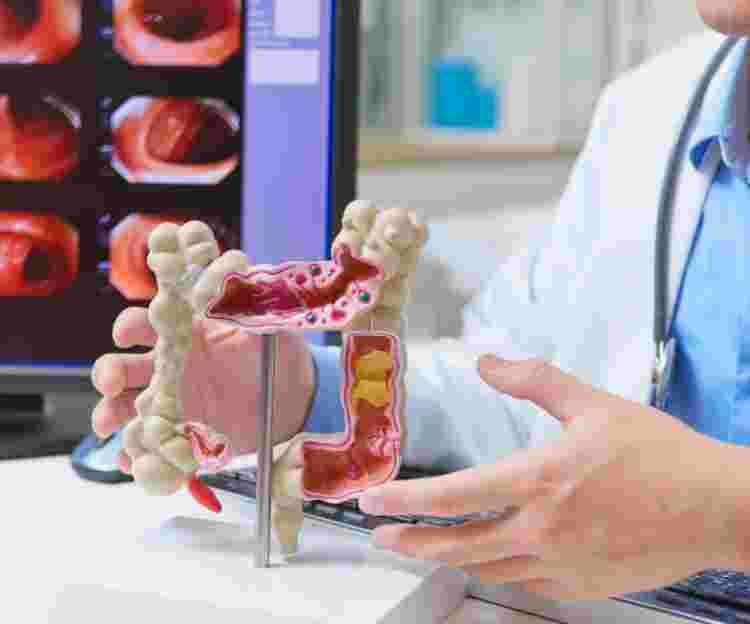 Take Charge of Your Health: Get Screened for Colorectal (Colon) Cancer